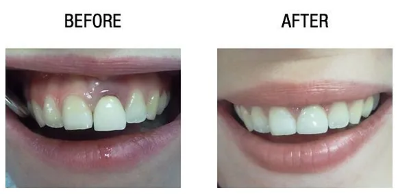 dental-surgery-1.webp
