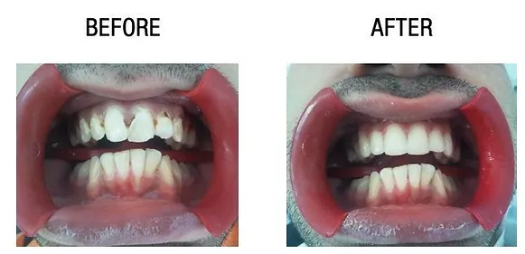 dental-surgery-before-after-1.webp